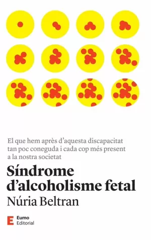 SINDROME D'ALCOHOLISME FETAL